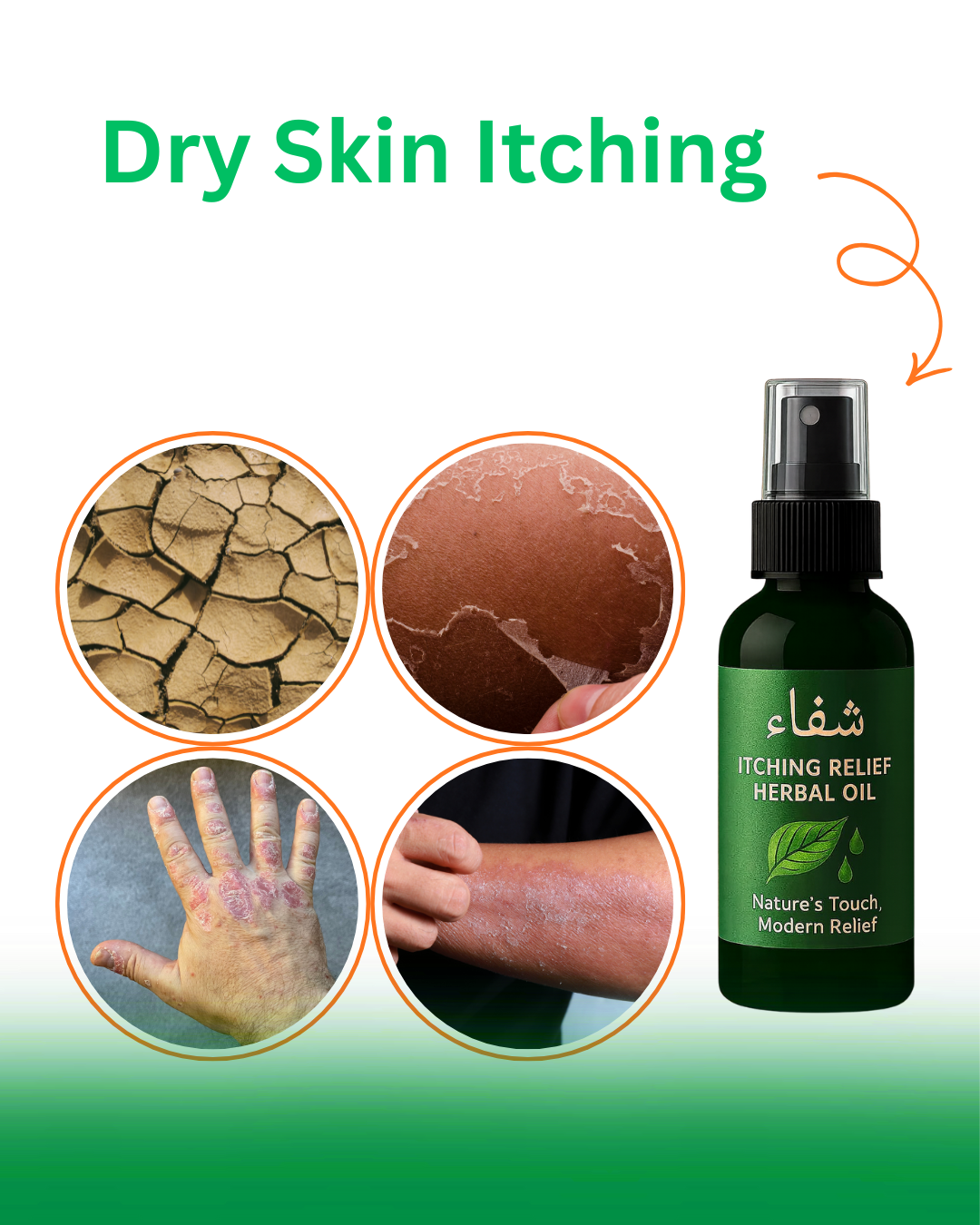 Herbal Itching Relief Oil-Fast Calm for Every itching